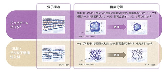 マトリックス構造